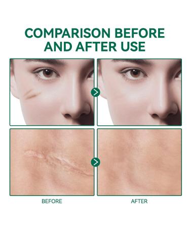 ScarRevita Advanced Repair Serum - Powerful Scar Gel for All Skin Types - Buy Online on GoSupps.com