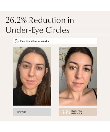 Caffeine Eye Serum for Women - Dark Circle Treatment, Brighten Puffy Eyes, Reduce Eye Bags and Wrinkles - Buy Online on GoSupps.com