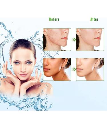 ASYBO 300 ML Aloe Vera Gel 99% Organic Pure Aloe Vera Hydrating Moisturizer Natural Aloe Cream for Dry Skin Sunburn Acne - Buy Online on GoSupps.com