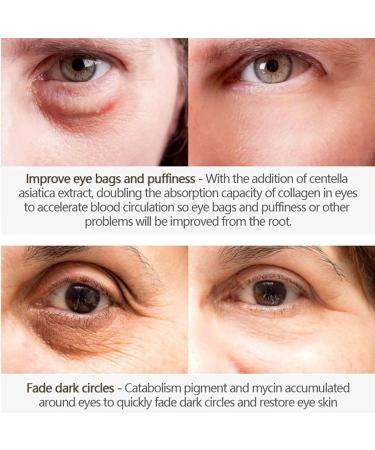 VYOFLA Magic Eye Cream - 2022 New Anti-aging Solution | Rapidly Removes Eye Bags, Wrinkles & Dark Circles in 28 Seconds | Vibrant Glamour Formula | 1PCS - Buy Online on GoSupps.com