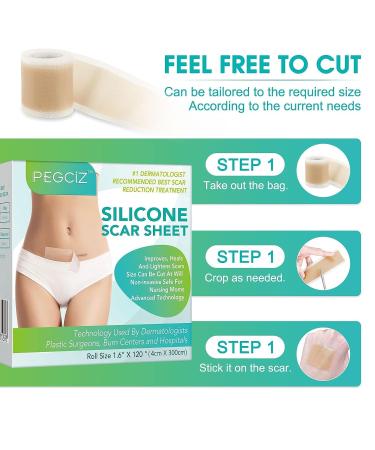 Silicone Scar Sheets - Professional Scar Removal Tape for C-Section, Surgery, Burn, Keloid, Acne - Soften and Flatten Scars - 1.6 x 120 - 3M Roll - Buy Online on GoSupps.com