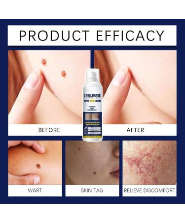 Face - Refreshing Blemish Renewal Spray 60ml | Refreshing Skin Spray - for Repairing Face and Body Care for Women - Buy Online on GoSupps.com