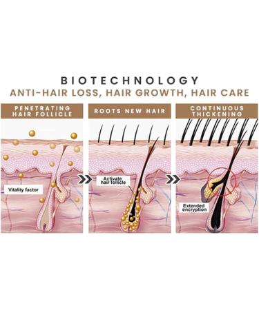  G n rique Hair Thickening Roller Hair Thickening Oil 50ml Fortifying Oil for Scalp and Hair | Scalp Moisturizer for Thick Hair Hair Oil - Buy Online on GoSupps.com