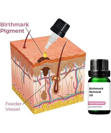 DUBUSH GFOUK German Birthmark Removal Oil Vitamin C Serum Collagen Dark Spot Repair Cream Hyperpigmentation Repair - Buy Online on GoSupps.com