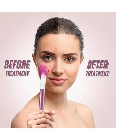 ASAB Light Therapy Acne Spot Treatment Pen Acne Scar Treatment Wrinkles Removal Spot Stick Blue and Red Light Therapy for Teenager Face Skincare Adult Beauty Device Fit for All Skin Types(Pink) - Buy Online on GoSupps.com