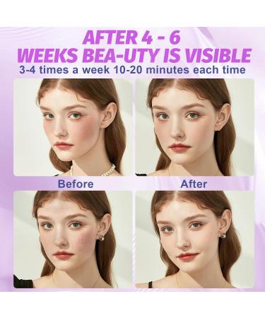 Upgrade Your Skin with Red Light Therapy - Near Infrared LED 660nm & 850nm for Face and Body | Fast International Shipping - Buy Online on GoSupps.com