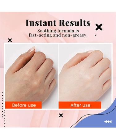 Hyaluronic Acid Hand Anti-Aging Essence | Moisturizing & Pore Shrinking Skin Care (1ml) - Repair Hand Lines & Restore Youthful Skin - Buy Online on GoSupps.com