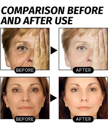 facial mask1 - Buy Online on GoSupps.com