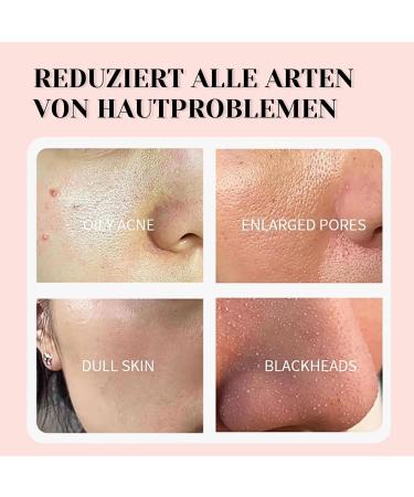 Dead Sea Mask Deep Cleansing Face Mask Skin Care Improve Blackheads Acne Dark Spots Even Skin Tone Face Mask Control Oil Refining Pores (Pink) - Buy Online on GoSupps.com