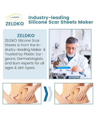 Medical-Grade Silicone Scar Sheets for Surgical Scars, Keloids, and Stretch Marks - 1.6 x 120 inches - Buy Online on GoSupps.com