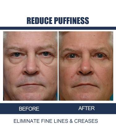 EAST MOON Men's Cool Tender Eye Cream - Anti-Wrinkle Firming & Puffiness Reducing Peptide Gel (2PCs) - Shop Internationally! - Buy Online on GoSupps.com