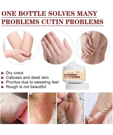 mingchengheng Dry Cracked Foot Cream | 50 Moisturizing Foot Care - Cracked Heel Repair Athlete's Foot Cream Moisturizing for Dry Feet Heels - Buy Online on GoSupps.com