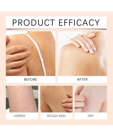 VKaoess Papaya Exfoliating Shower Gel with Vitamin E Brightening Body Wash for Smooth Soft Skin Moisturizing & Nourishing Bath Cream Soft Refreshing Fruity Fragrance for All Skin Types 5 Bottles - Buy Online on GoSupps.com