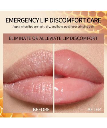 KYDA Bee Lip Balm 2 Pcs - Moisturizing Honey Lip Care for Dry Chapped Lips - Natural Smooth Balm for Women & Girls - Buy Online on GoSupps.com