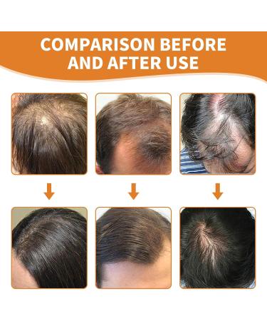 XdealCozyxc 60ML Pumpkin Seed Oil for Hair Growth Skin Face Eyebrow and Eyelash Growth Improve Hair Loss and Nourishes Scalp - Buy Online on GoSupps.com