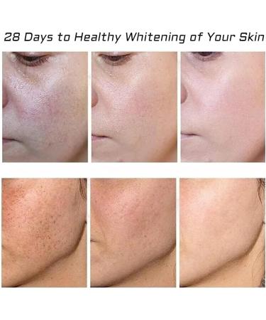 PHFTRCEW 2pcs Whitening Freckle CreamAcne Scar Removal Treatment Pigmentation Removal for FaceSpot Off Freckle Whitening Antiwrinkle Moisturizing Freckle Remover Cream - Buy Online on GoSupps.com