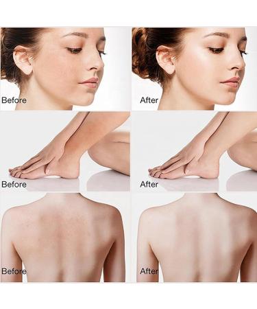 Coffee Body Scrub | Coffee Scrub Body Exfoliator | Moisturizing and Exfoliatings Body Face Hand Foot Scrub | Deep Cleansing Body Exfoliator for All Skin Types - Buy Online on GoSupps.com