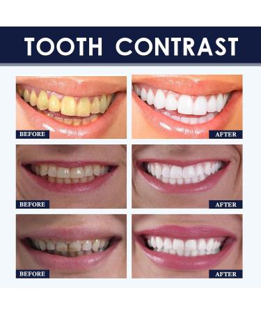 2pcs Teeth Whitening Powder - 50g Probiotics Tooth Powder for a Bright Smile Remove Stain Yellow Bad Breath Fresh - Tea Coffee Wine & Smoking Stain Remover - Buy Online on GoSupps.com