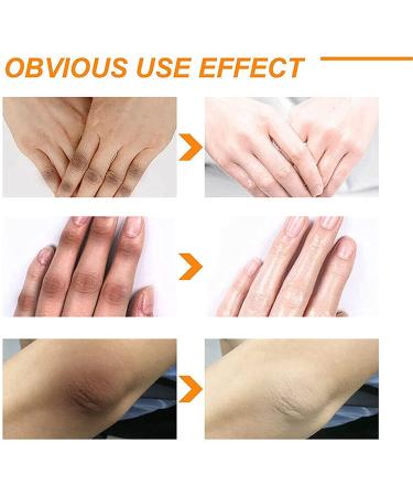 Body Whitening Cream & Peeling Lotion - Orange Peel Skin Lightening Exfoliating & Pore Tightening for Dark Skin (2PCs) - Buy Online on GoSupps.com