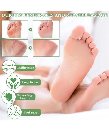 Leg up Urea cream 40 percent - Buy Online on GoSupps.com