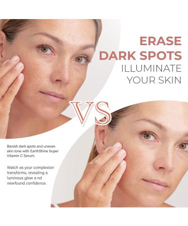 EarthShine Super C Serum for Women Over 70 | Hydrating Vitamin C Serum for Mature Skin - Firm Lift & Smooth Wrinkles - 1.0 Fl Oz - Buy Online on GoSupps.com