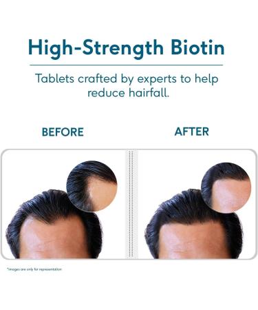 Biotin 10000mcg Supplement for Hair Growth Strong Hair and Glowing Skin Fights Nail Brittleness 90 Biotin Tablets - Buy Online on GoSupps.com