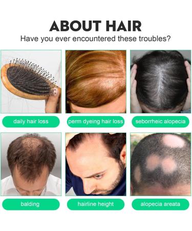  Hongjingda Hair Growth Oil 120ml Spray with Ginger Root Oil Melon Extract Fast Acting Hair Growth Serum - Buy Online on GoSupps.com