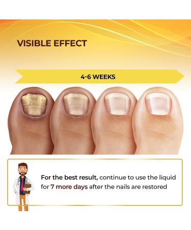 Maximum Strength Nail Repair Treatment for Toe and Fingernail Fungal Repair - Hydrates and Renews Damaged Nails - Buy Online on GoSupps.com