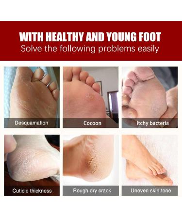 5 Pieces feet exfoliating masks Foot Peel Mask Hydrating foot Spa Moisturizing skin callus remover Smoothing touch skin for Cracked Hard Dead Skin Calluses - Buy Online on GoSupps.com