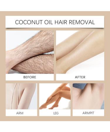 WRANBAO Rozino Facial Hair Removal Cream Gentle Hair Removal for Smooth Skin Suitable for Men and Women Upper Lip and Chin 100g 3 Pieces 3 Pieces - Buy Online on GoSupps.com