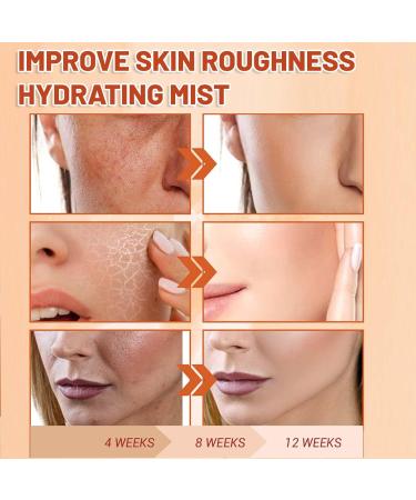 Vitamin C Face Mist VC Skin Brightening Facial Spray Skin Barrier Repair Improve Uneven Skin Relieves Dark Spots Spray Moisturiser VC Hydrating Serum Spray Deeply Moisturizing - Buy Online on GoSupps.com