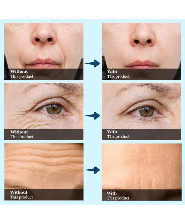Eye Cream for Under Eye Bags and Wrinkles Eye Tightener for Temporary Firming Eye Bags Wrinkles Puffy Eyes Dark Circles for Women Men Mature Skin 0.17 FL OZ (Pack of 1) - Buy Online on GoSupps.com