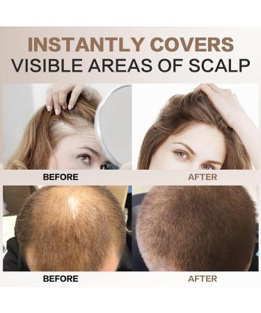 Approach Waterproof Hairline Powder #10 Med Blonde | Instant Hair Concealer for Thinning Hair - Unisex Solution - Buy Online on GoSupps.com