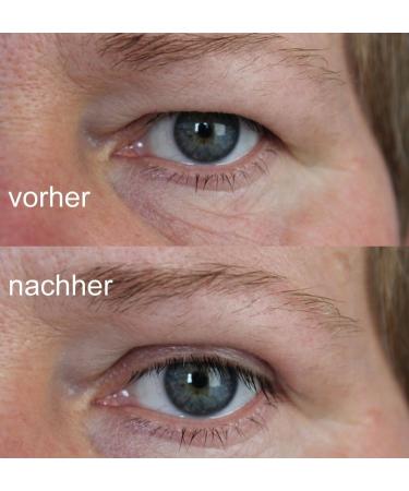 Foli Schluepflid Tape - Eye Lifting Lid Stickers for Beautiful Open Eyes | 60 Pairs (2x30 Pairs) - Perfect for Women & Girls - Buy Online on GoSupps.com