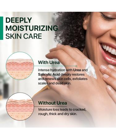 40% Urea Cream for Feet - Ultra Moisturizing Repair Treatment for Dry Cracked Heels & Calluses with 2% Salicylic Acid - Softens & Exfoliates Hands Knees Elbows - Buy Online on GoSupps.com
