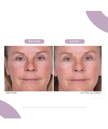 Serious Skincare Reverse Lift Firming Set - 4 Piece Facial Cream Correc-Chin Serum & Eye Cream - Firm Lift & Smooth Wrinkles - Lightweight Formula for All Skin Types - Buy Online on GoSupps.com