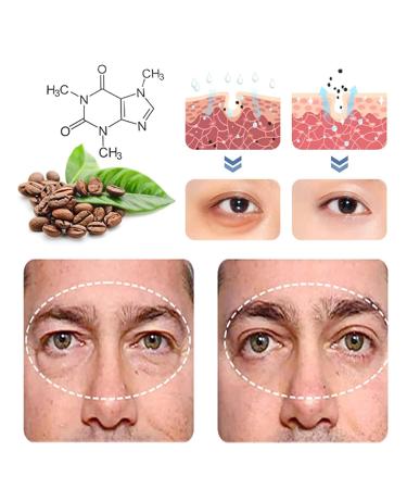 Buy Carvvo & Lovilds Awakening Peptide Eye Gel - Anti-Aging 2/4/8 Piece Eye Cream for Dark Circles & Puffiness - Buy Online on GoSupps.com