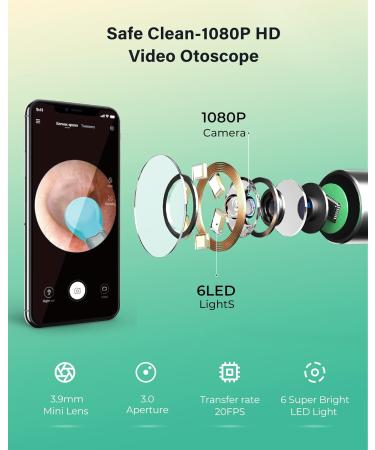 Xlife Ear Wax Removal 1080P HD Camera & Blackhead Remover Kit - Ear Cleaner for iPhone, iPad & Android - 3.5mm Ultra-Thin Lens - C3 White - Buy Online on GoSupps.com