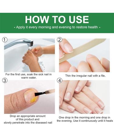 Fungal Nail Treatment For Toenails - Extra Strong Nail Fungus Treatment For Anti Fungal Nail Treatment - Fungal Nail Polish For Fix & Renew Damaged Broken Nails - Buy Online on GoSupps.com