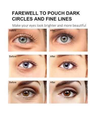 Retinol Eye balm Stick Anti-Aging Firming & Moisturizing Balm Moisturizing & anti-ging Firming Balm Under EyeCream Anti Aging Reduces Puffiness Fine Lines with Upgraded Formula 0.1 OZ/3g(1pc) 1pc 1 Ounce (Pack of 1) - Buy Online on GoSupps.com