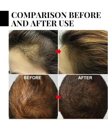 Ycydazi Centella Clean Batana Shampoo & Conditioner Set for all hair types strengthens and nourishes clarifies and thickens the hair 100ml shampoo + 220ml hair mask - Buy Online on GoSupps.com