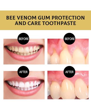 Dyceittdia Gum Protection Toothpaste - 2pcs 110g | Deep Cleaning Stain Removal & Whitening - Buy Online on GoSupps.com