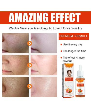 Vitamin C Serum For Face Serum 10% Fresh Vitamin C + 5% Sweet Orange Extract with Hyaluronic Acid For Face Hydrate Skin & Even Skin Tone Anti Aging & Wrinkle Face Serum for Women - Buy Online on GoSupps.com