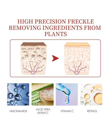 2Pcs Crema Para Manchas Oscuras En La Cara Cremas Para Las Manchas de La Cara Crema Aclaradora Para Piel Manchas En Cara - Buy Online on GoSupps.com