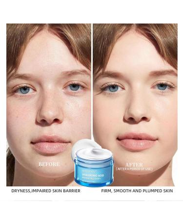 Buy Hyaluronic Acid Moisturizing Cream | Lightweight Non-Greasy Hydration for Dry Skin - 50g - Buy Online on GoSupps.com