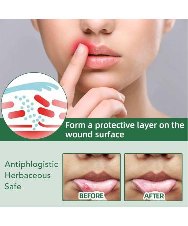 Herbal Oral Spray for Pain Relief | Natural Daily Care | 40ml Soothing Treatment - Buy Online on GoSupps.com