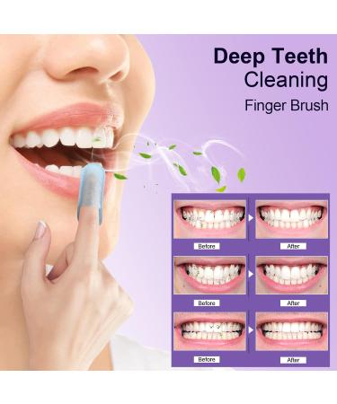 Buy MySmile Teeth Wipes - 100pcs Mint Flavor Deep Cleaning Oral Brush Ups for Fresh Breath & Teeth Care - Buy Online on GoSupps.com