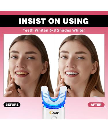 CHICY Teeth Whitening Kit with LED Accelerator Light - Removes Coffee, Smoking, Wine Stains - Buy Online on GoSupps.com