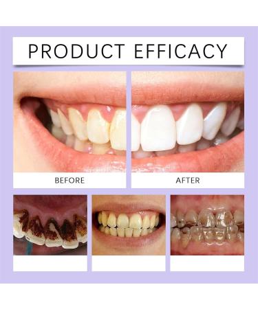 5 Days Teeth Whitening Powder Tooth Color Correction Powder Mineral Teeth Cleaning Powder Tooth Stain Remover Powder Protect Gums and Freshen Breath - Buy Online on GoSupps.com