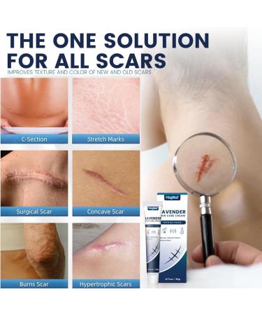 RedOceansM Scar gel scar removal cream scar care gel scar repair cream stretch mark creams remover 20 g scar ointment after use natural scar gel reduces the visibility of - Buy Online on GoSupps.com